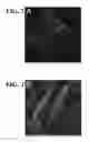 Fig. 03 - COMPOSITIONS AND METHODS FOR URINARY BLADDER REGENERATION
