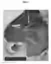 Fig. 10 - COMPOSITIONS AND METHODS FOR URINARY BLADDER REGENERATION