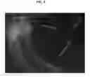 Fig. 11 - COMPOSITIONS AND METHODS FOR URINARY BLADDER REGENERATION