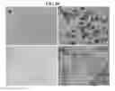 Fig. 13 - COMPOSITIONS AND METHODS FOR URINARY BLADDER REGENERATION