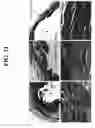 Fig. 24 - COMPOSITIONS AND METHODS FOR URINARY BLADDER REGENERATION