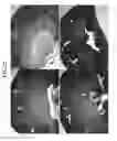 Fig. 25 - COMPOSITIONS AND METHODS FOR URINARY BLADDER REGENERATION