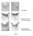 Fig. 05 - Methods of transplanting chondrocytes