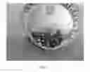 Fig. 02 - MALLEABLE IMPLANTS INCLUDING AN OXYSTEROL AND METHODS OF USE
