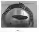 Fig. 03 - MALLEABLE IMPLANTS INCLUDING AN OXYSTEROL AND METHODS OF USE