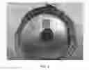 Fig. 04 - MALLEABLE IMPLANTS INCLUDING AN OXYSTEROL AND METHODS OF USE