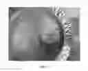 Fig. 06 - MALLEABLE IMPLANTS INCLUDING AN OXYSTEROL AND METHODS OF USE