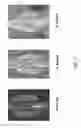 Fig. 08 - MALLEABLE IMPLANTS INCLUDING AN OXYSTEROL AND METHODS OF USE