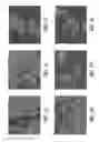 Fig. 02 - Reduction of implant infection via tunable stimulation of localized adaptive immune response