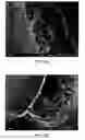 Fig. 09 - Morphology Profiles For Control Of Agent Release Rates From Polymer Matrices