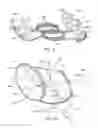 Fig. 03 - Systems and methods for expression of breast milk