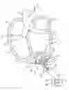 Fig. 01 - Self-contained heart pump