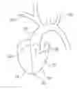 Fig. 01 - Aortic pump devices and methods