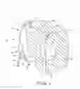 Fig. 02 - DIALYSIS CATHETER