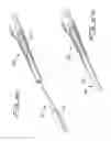 Fig. 16 - DIALYSIS CATHETER