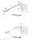 Fig. 20 - DIALYSIS CATHETER