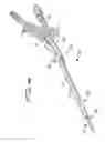 Fig. 34 - DIALYSIS CATHETER