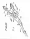 Fig. 41 - DIALYSIS CATHETER