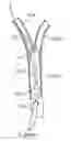 Fig. 01 - Methods and systems for establishing retrograde carotid arterial blood flow