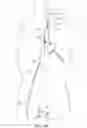 Fig. 03 - Methods and systems for establishing retrograde carotid arterial blood flow