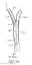 Fig. 06 - Methods and systems for establishing retrograde carotid arterial blood flow