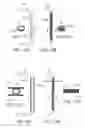 Fig. 16 - Methods and systems for establishing retrograde carotid arterial blood flow