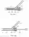 Fig. 22 - Methods and systems for establishing retrograde carotid arterial blood flow