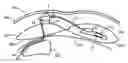 Fig. 01 - Implantable infusion system