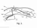 Fig. 02 - Implantable infusion system