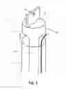 Fig. 06 - Implantable infusion system