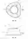 Fig. 03 - Systems and methods for identifying and locating an implanted device