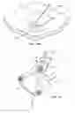 Fig. 11 - Systems and methods for identifying and locating an implanted device