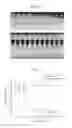 Fig. 05 - Automatic recharging micro-jet drug injection device preventing jet speed down problem of repeated injection