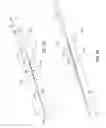 Fig. 02 - Length-adjustable catheter and method that employs a length-adjustable catheter to treat vascular pathologies