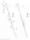 Fig. 06 - Length-adjustable catheter and method that employs a length-adjustable catheter to treat vascular pathologies