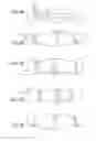Fig. 04 - METHODS AND DEVICES FOR TREATING THE CORNEA