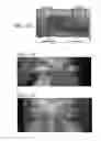 Fig. 07 - METHODS AND DEVICES FOR TREATING THE CORNEA