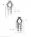 Fig. 06 - Electrode arrays and their lead for use in biological implants