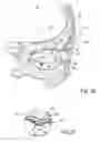 Fig. 05 - Systems and methods for treatment of dry eye