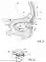 Fig. 07 - Systems and methods for treatment of dry eye