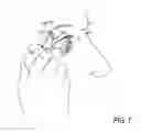 Fig. 10 - Systems and methods for treatment of dry eye