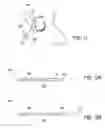 Fig. 15 - Systems and methods for treatment of dry eye
