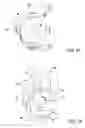 Fig. 16 - Systems and methods for treatment of dry eye