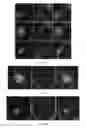 Fig. 45 - METHODS AND COMPOSITIONS FOR TREATING MENTAL DISORDERS AND CONDITIONS