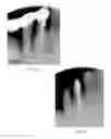 Fig. 09 - Laser assisted wound healing protocol and system