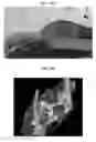 Fig. 32 - Phosphor-containing drug activator activatable by a Monte Carlo derived x-ray exposure, system containing the activator, and methods for use