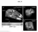 Fig. 33 - Phosphor-containing drug activator activatable by a Monte Carlo derived x-ray exposure, system containing the activator, and methods for use