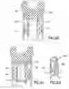Fig. 41 - Density phase separation device