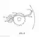 Fig. 07 - Red blood cell washing system