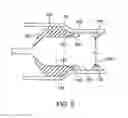 Fig. 05 - Method of increasing stent retention of bioabsorbable scaffolding with a sheath